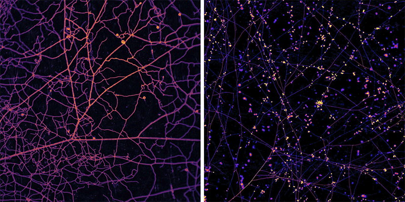 Filament networks of microscopic fungi lit with ultraviolet.