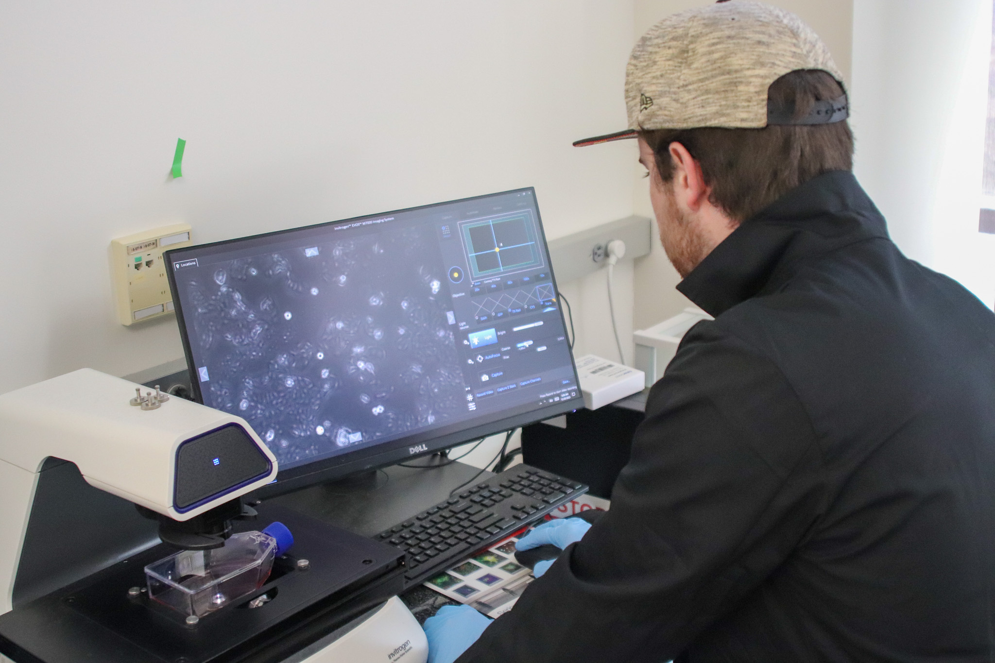 ben mosier looks at breast cancer cells under microscopr