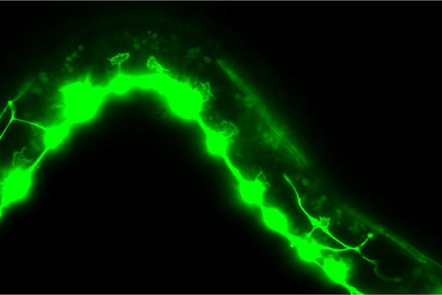 Axonal growth cones in C. elegans worms. When src-1 is gone (this picture) the growth cones are large and cannot focus where they are going.