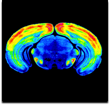 brain image