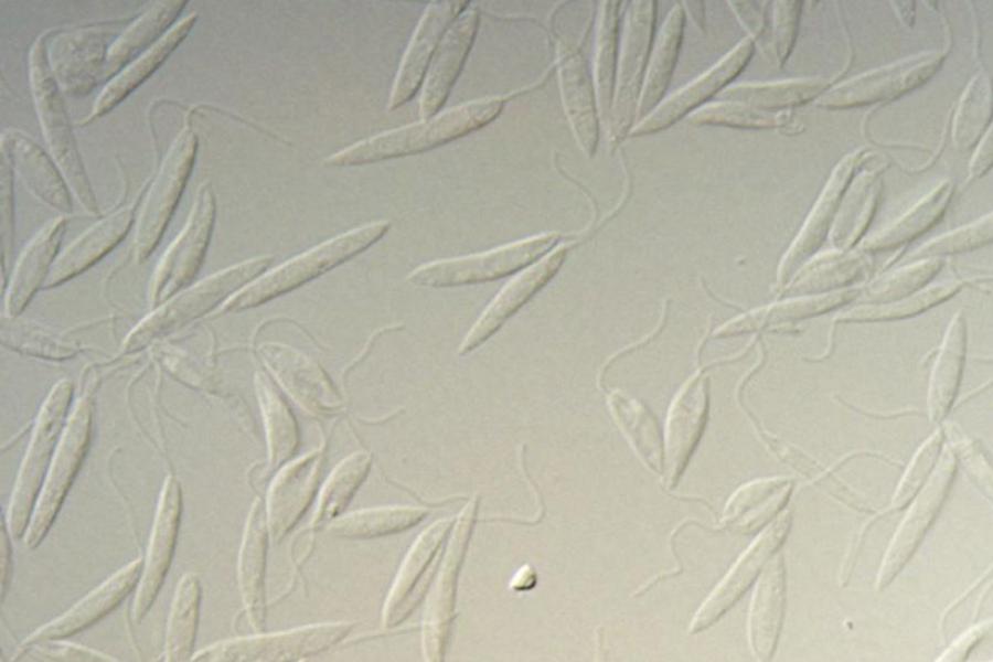 Leishmania major promastigotes in culture photographed via microscope