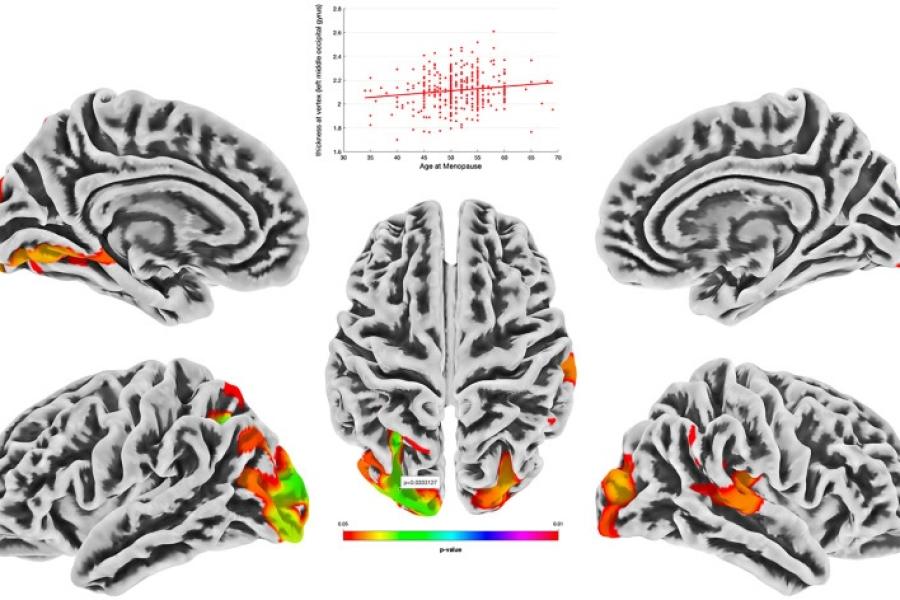 Brain scans highlighting areas (in red and green) where women who started menopause at an older age tended to have a thicker outer layer of the brain, known as the cortex.