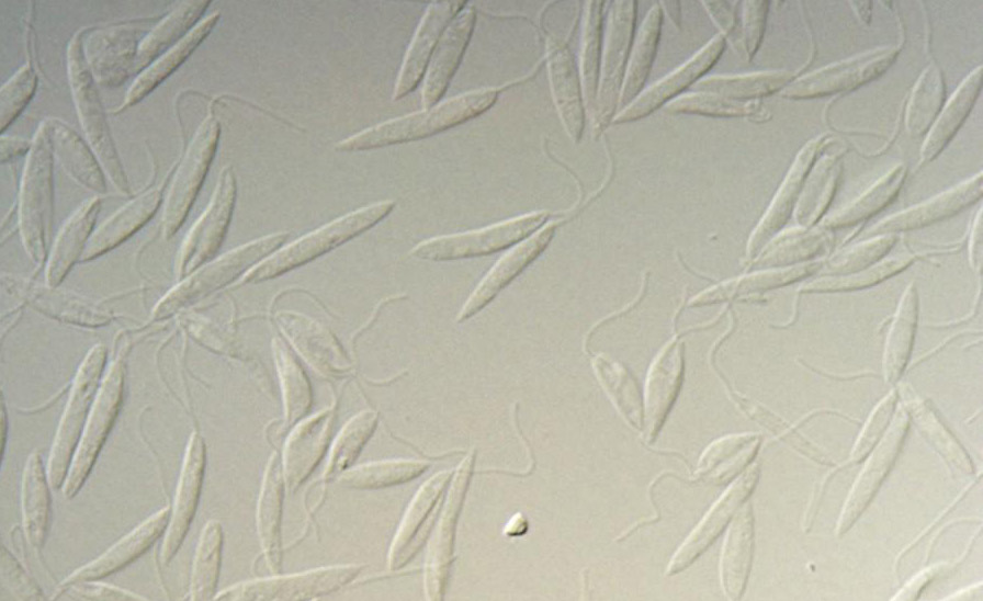 Leishmania major promastigotes in culture photographed via microscope