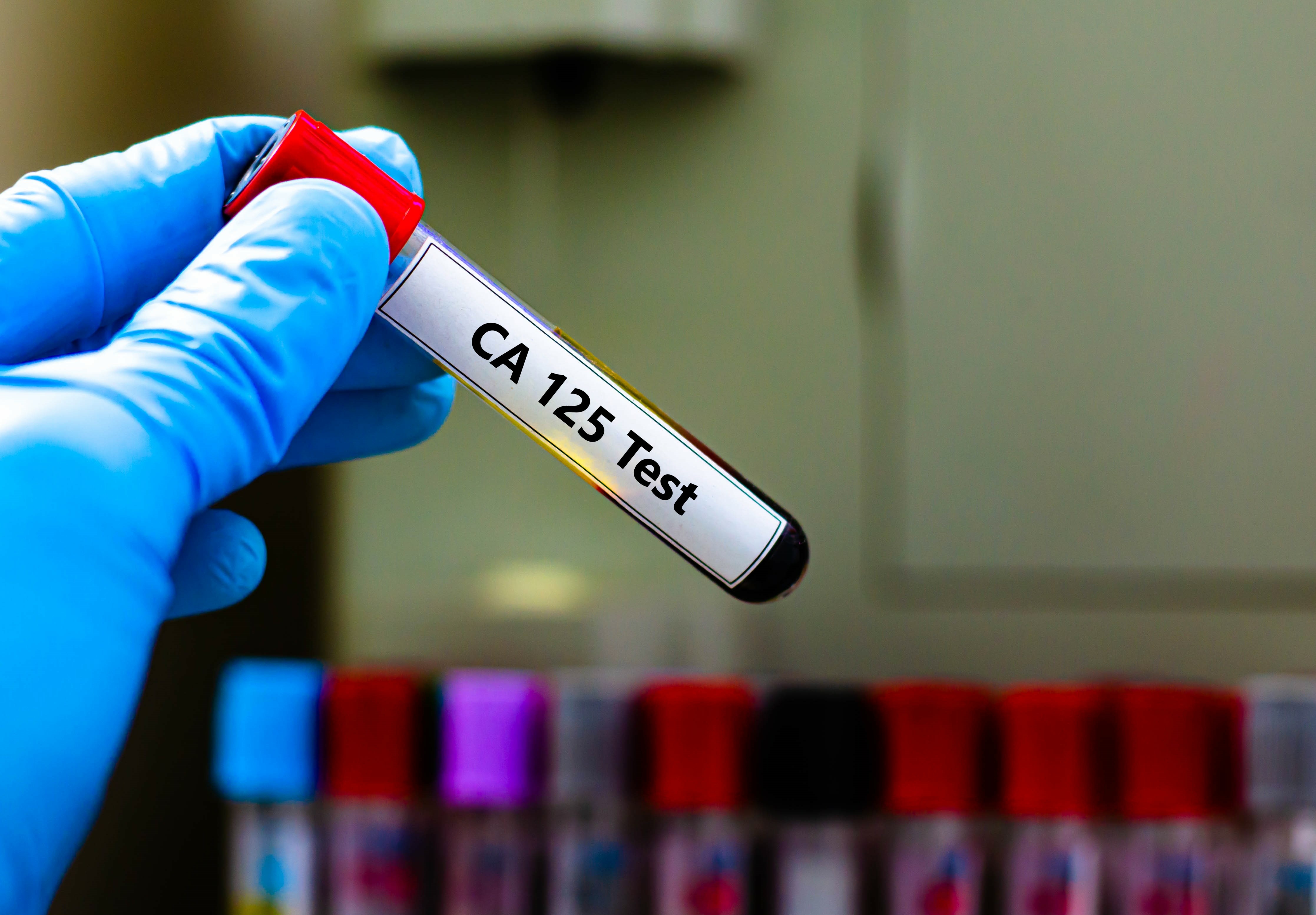 CA125 Test Tube