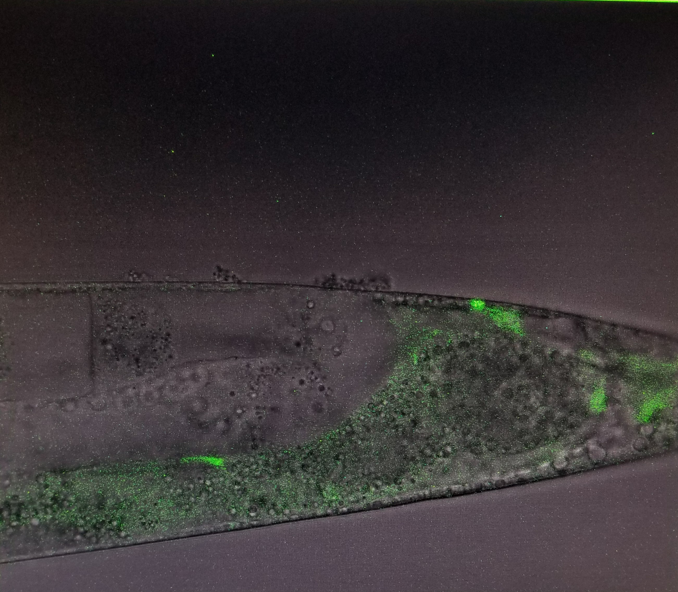 C. Elegans viewed under confocal microscope