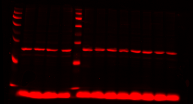 beta-actin stain in florescent red